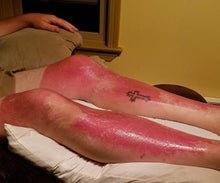 Load image into Gallery viewer, Natural Non-Toxic Sunburn Cream Meadow Stream Aromatherapy