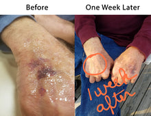 Load image into Gallery viewer, Bruise Reduction Meadow Stream Aromatherapy Custom Blends